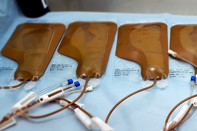 fæcestransplantation sættes i system - andres afføring kan redde liv